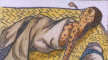 natives-smallpox-everett-clra001_bz063