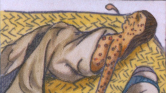 natives-smallpox-everett-clra001_bz063